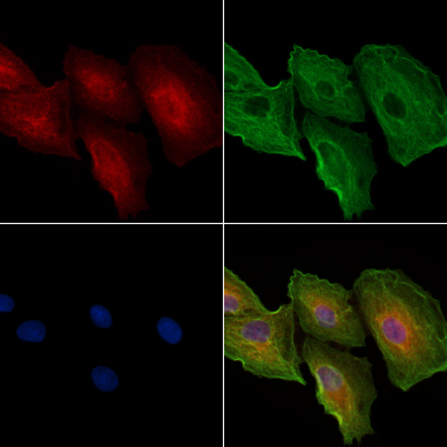 CDH16 Antibody in Immunocytochemistry (ICC/IF)