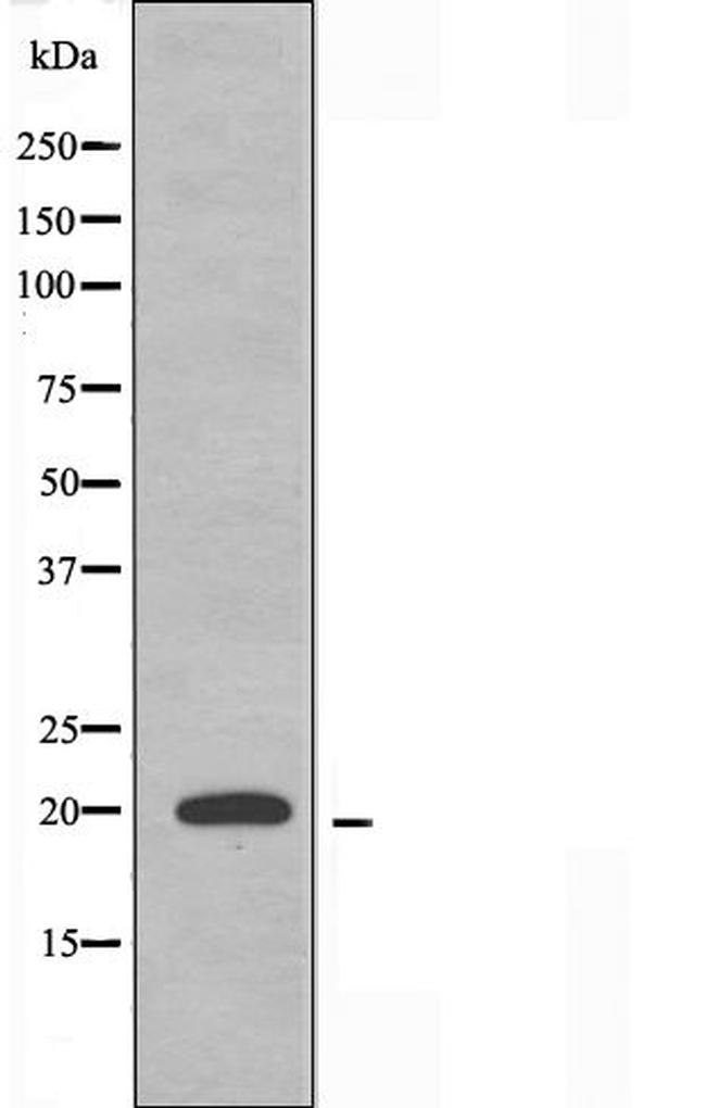 COX4I2 Antibody in Western Blot (WB)