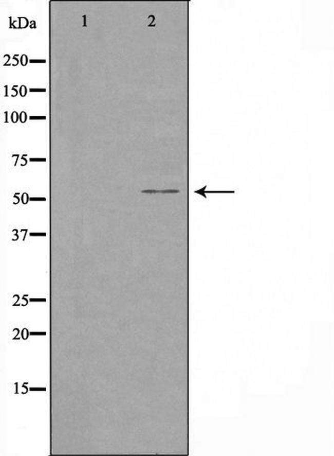 CYP1A1/CYP1A2 Antibody in Western Blot (WB)