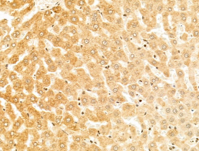 CYP27A1 Antibody in Immunohistochemistry (Paraffin) (IHC (P))