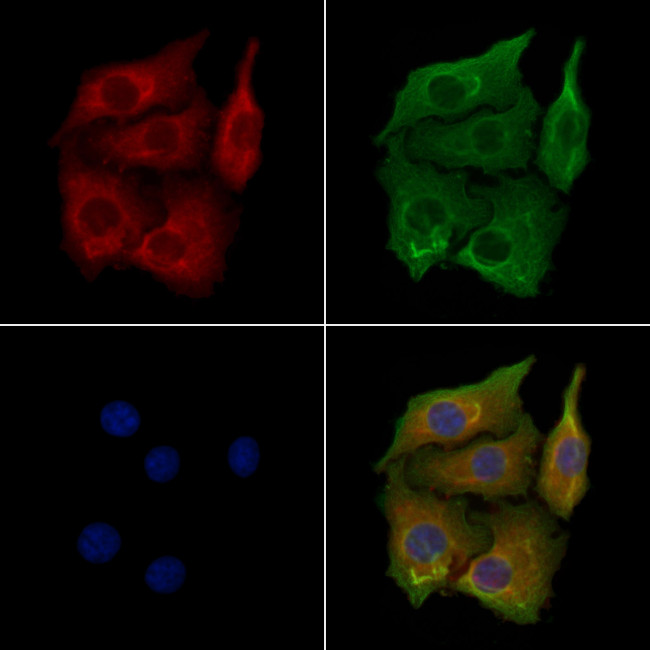 CYP2R1 Antibody in Immunocytochemistry (ICC/IF)