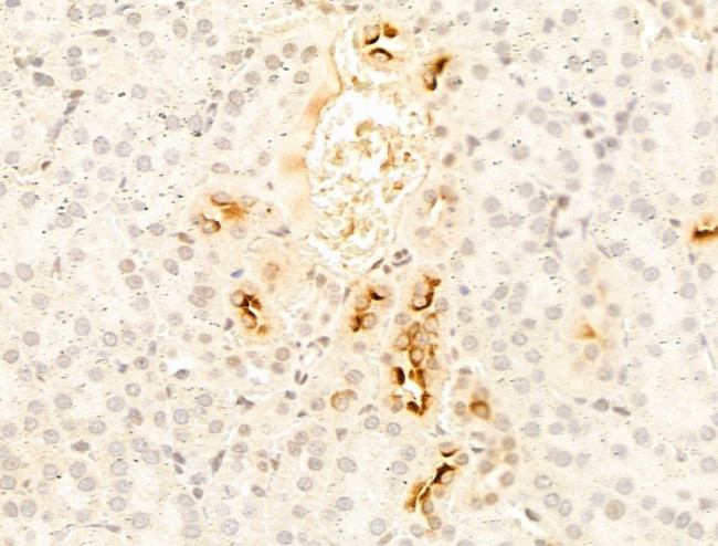 CYP2R1 Antibody in Immunohistochemistry (Paraffin) (IHC (P))