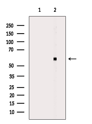 CYP2W1 Antibody in Western Blot (WB)