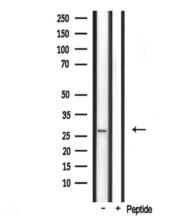 FGF23 Antibody in Western Blot (WB)