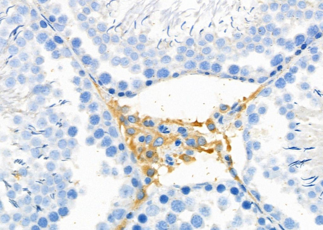 IL17RA Antibody in Immunohistochemistry (Paraffin) (IHC (P))