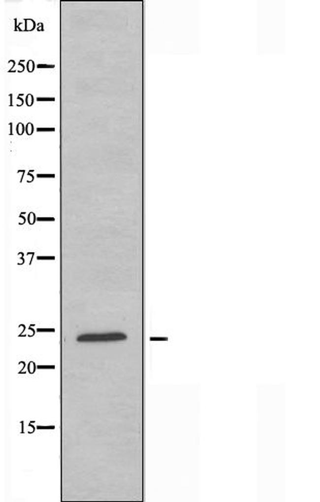 Bcl-W Antibody in Western Blot (WB)