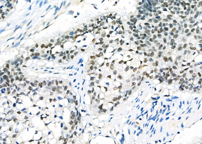 DATF1 Antibody in Immunohistochemistry (Paraffin) (IHC (P))