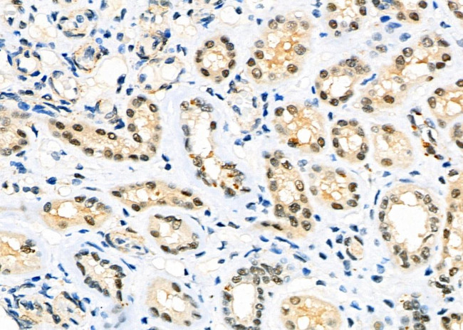 DATF1 Antibody in Immunohistochemistry (Paraffin) (IHC (P))