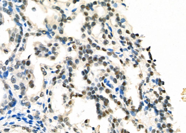 DATF1 Antibody in Immunohistochemistry (Paraffin) (IHC (P))