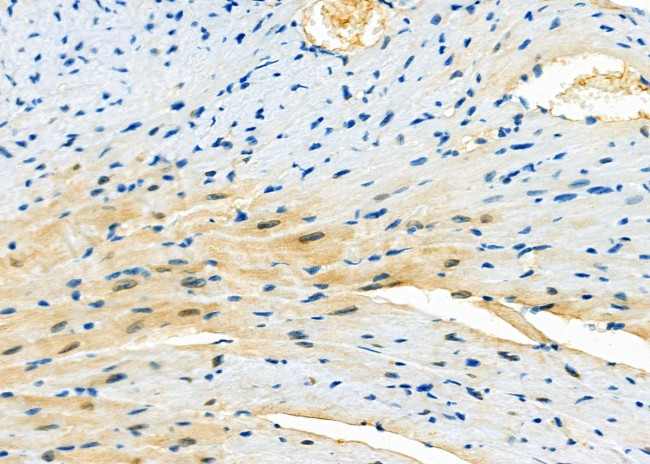 DATF1 Antibody in Immunohistochemistry (Paraffin) (IHC (P))