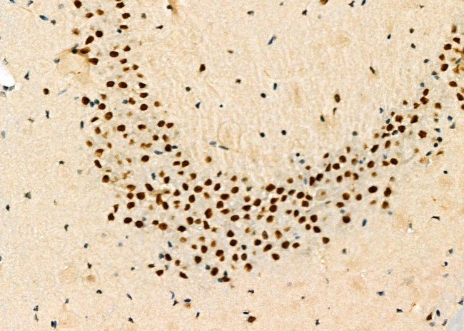 DATF1 Antibody in Immunohistochemistry (Paraffin) (IHC (P))