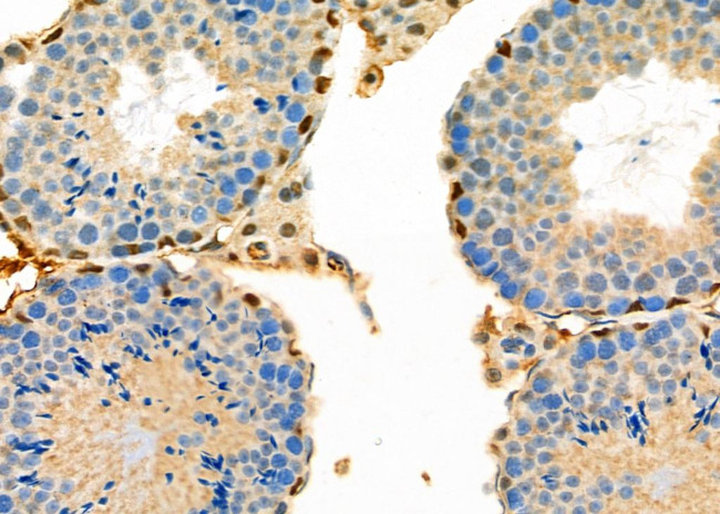 DATF1 Antibody in Immunohistochemistry (Paraffin) (IHC (P))