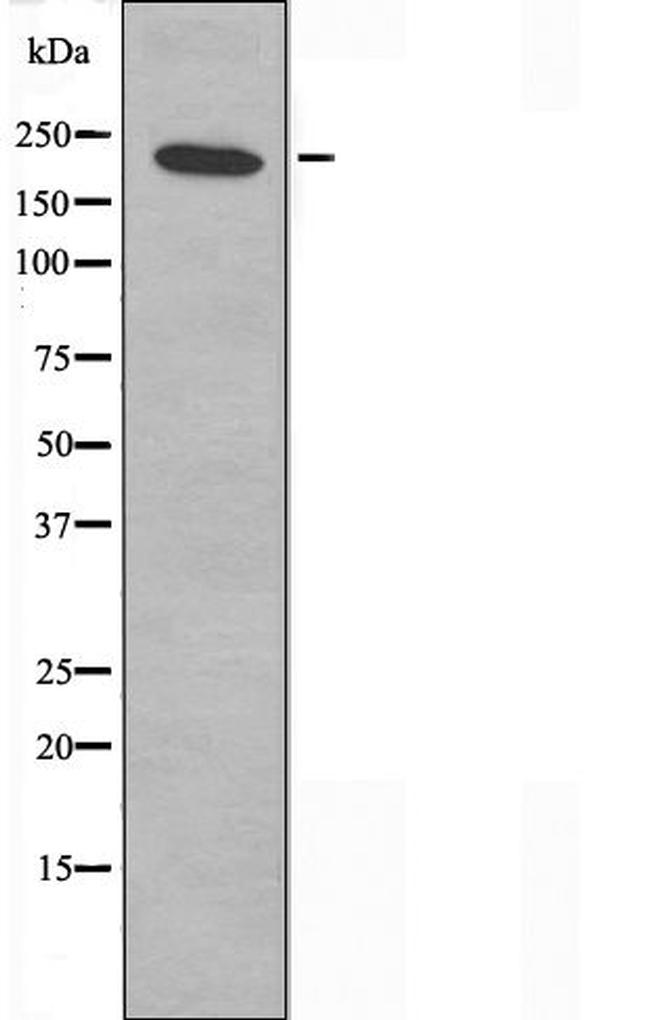 DATF1 Antibody in Western Blot (WB)