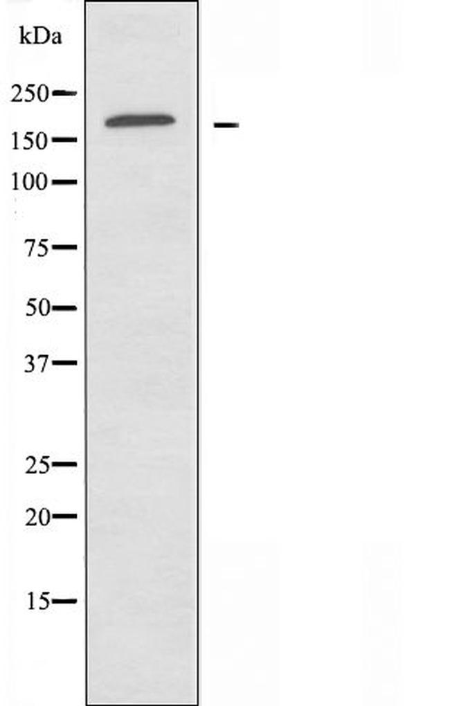 Laminin gamma-1 Antibody in Western Blot (WB)