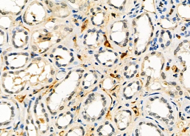 AGPAT3 Antibody in Immunohistochemistry (Paraffin) (IHC (P))