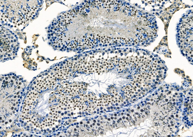 AGPAT3 Antibody in Immunohistochemistry (Paraffin) (IHC (P))