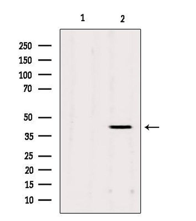 AGPAT3 Antibody in Western Blot (WB)