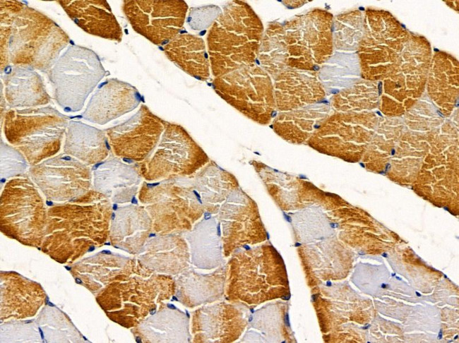 PSMD11 Antibody in Immunohistochemistry (Paraffin) (IHC (P))