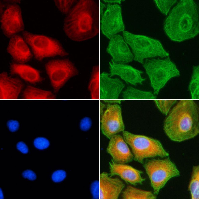 MRPL18 Antibody in Immunocytochemistry (ICC/IF)