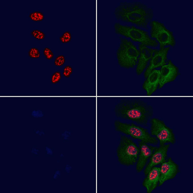 RPL11 Antibody in Immunocytochemistry (ICC/IF)