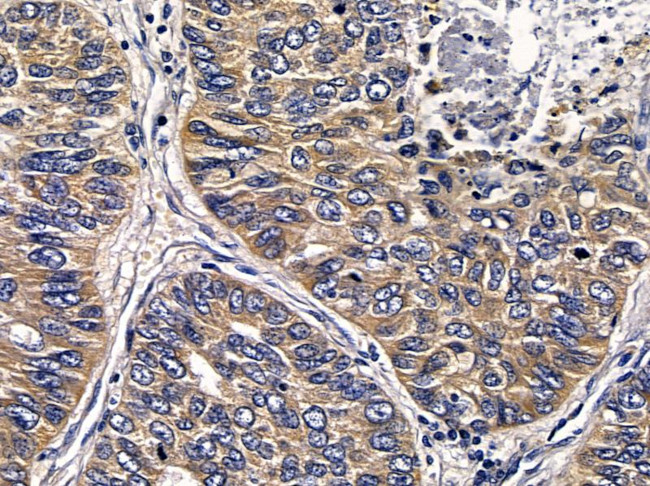 ABHDB Antibody in Immunohistochemistry (Paraffin) (IHC (P))