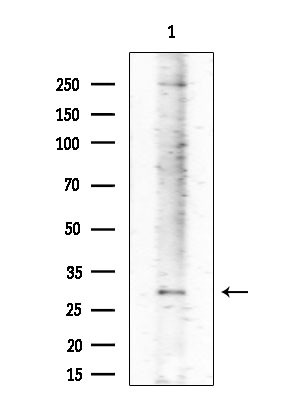 ABHDB Antibody in Western Blot (WB)