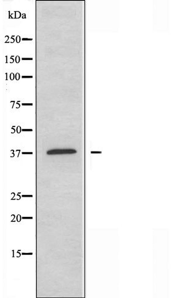 ABHD6 Antibody in Western Blot (WB)