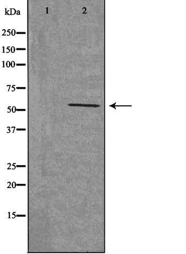 CHRNB1 Antibody in Western Blot (WB)