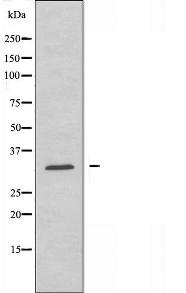 ACBD6 Antibody in Western Blot (WB)