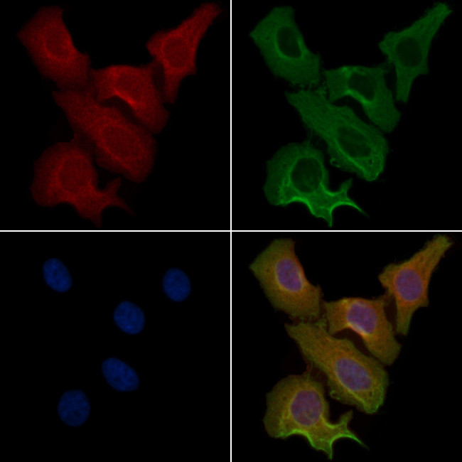 ACOT1 Antibody in Immunocytochemistry (ICC/IF)