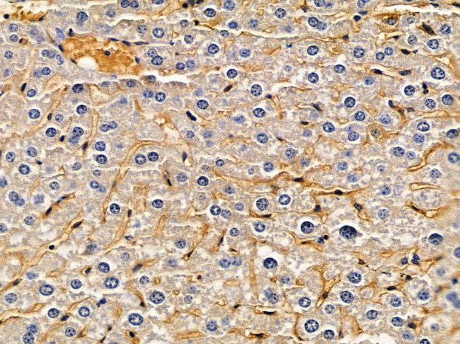 ACOT1 Antibody in Immunohistochemistry (Paraffin) (IHC (P))