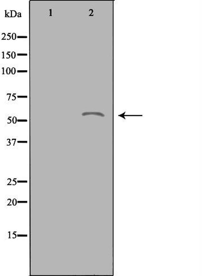 ACOT2 Antibody in Western Blot (WB)