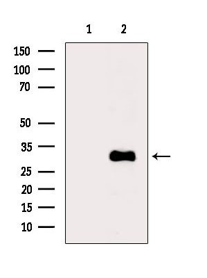 ACOT8 Antibody in Western Blot (WB)