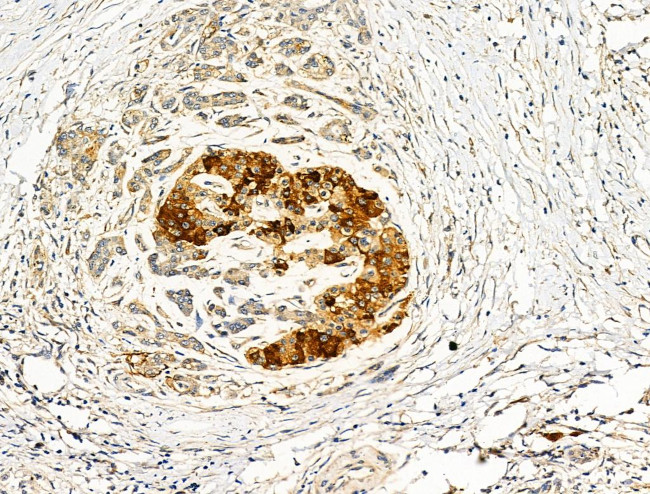 ADAMTS18 Antibody in Immunohistochemistry (Paraffin) (IHC (P))