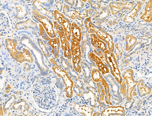 ADAMTS18 Antibody in Immunohistochemistry (Paraffin) (IHC (P))