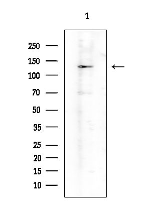 ADAMTS18 Antibody in Western Blot (WB)