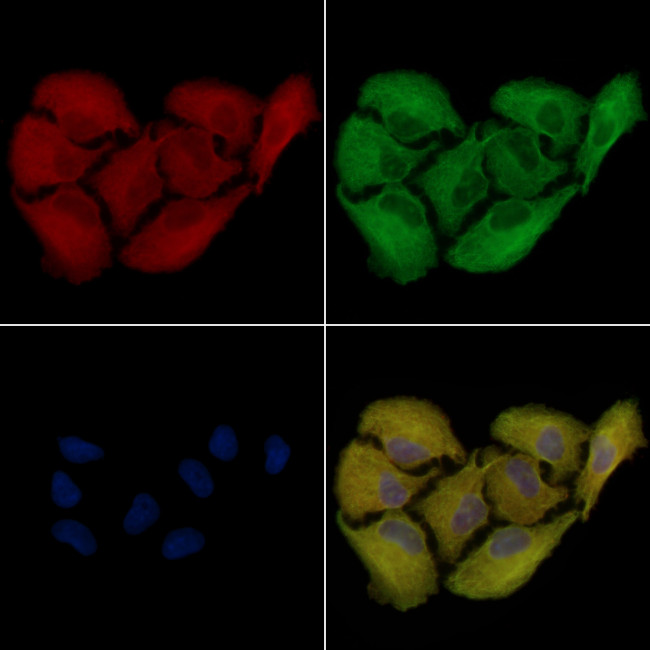 AKR1C2 Antibody in Immunocytochemistry (ICC/IF)