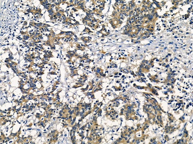 AKR1C2 Antibody in Immunohistochemistry (Paraffin) (IHC (P))