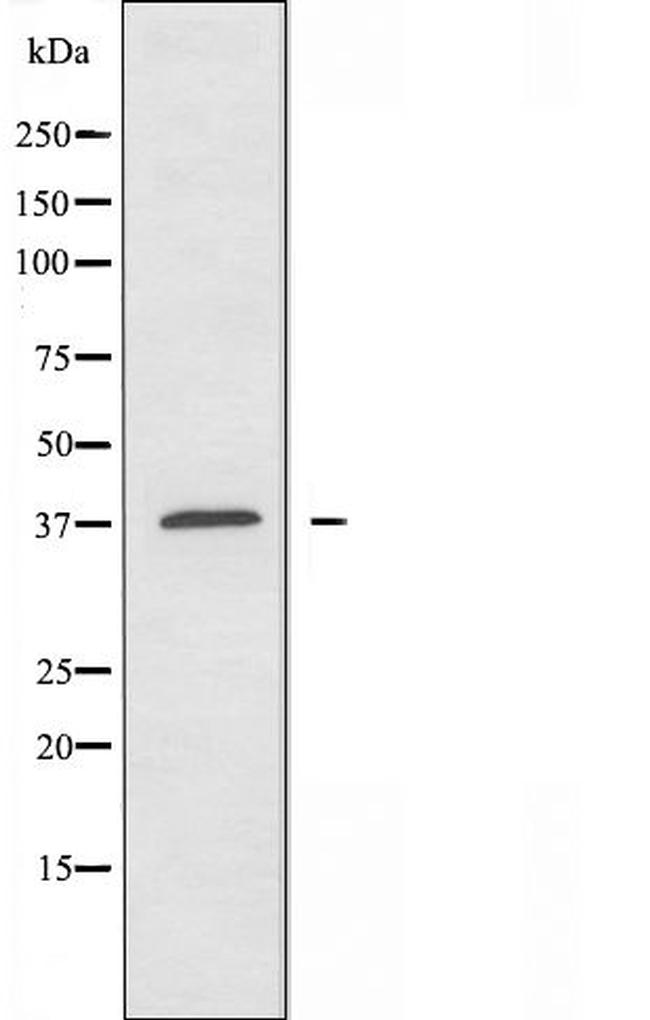 A4GNT Antibody in Western Blot (WB)