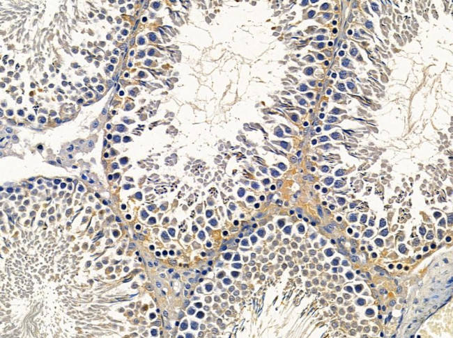 SCNN1D Antibody in Immunohistochemistry (Paraffin) (IHC (P))