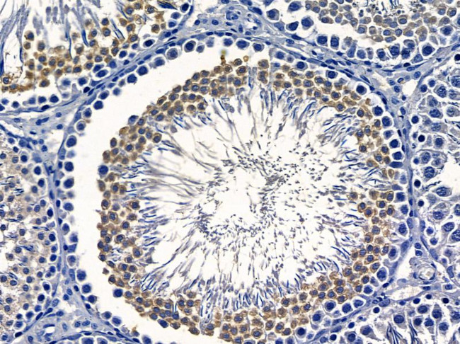 NECAB3 Antibody in Immunohistochemistry (Paraffin) (IHC (P))