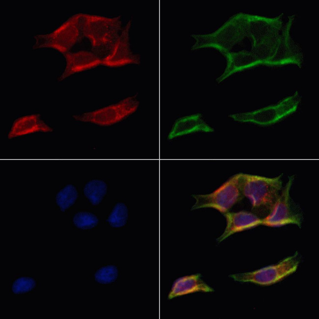 ATP5H Antibody in Immunocytochemistry (ICC/IF)