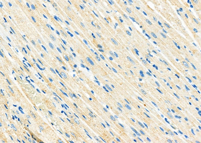 ATP5H Antibody in Immunohistochemistry (Paraffin) (IHC (P))