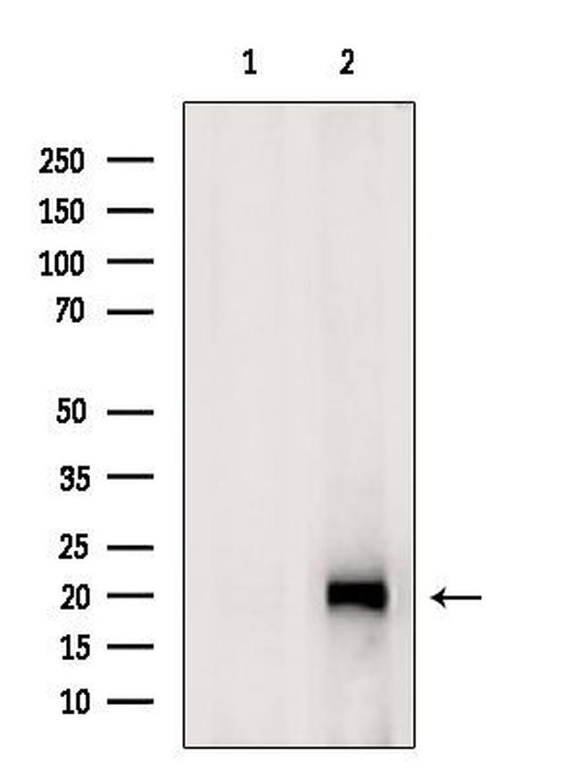 ATP5H Antibody in Western Blot (WB)