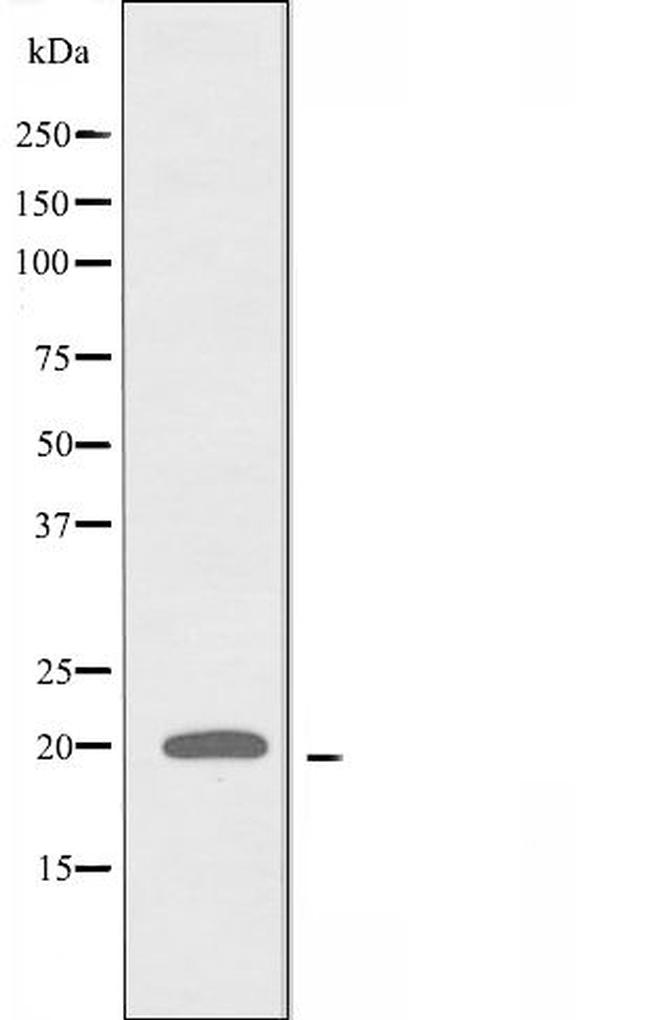 ATP5L2 Antibody in Western Blot (WB)