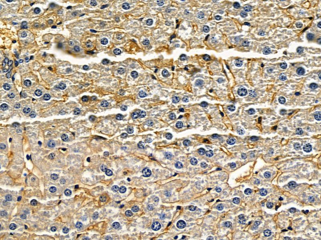 ATP5S Antibody in Immunohistochemistry (Paraffin) (IHC (P))