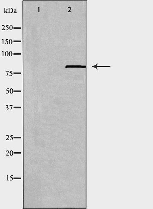 ABCB7 Antibody in Western Blot (WB)