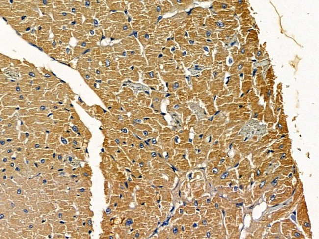 Atrophin 1 Antibody in Immunohistochemistry (Paraffin) (IHC (P))