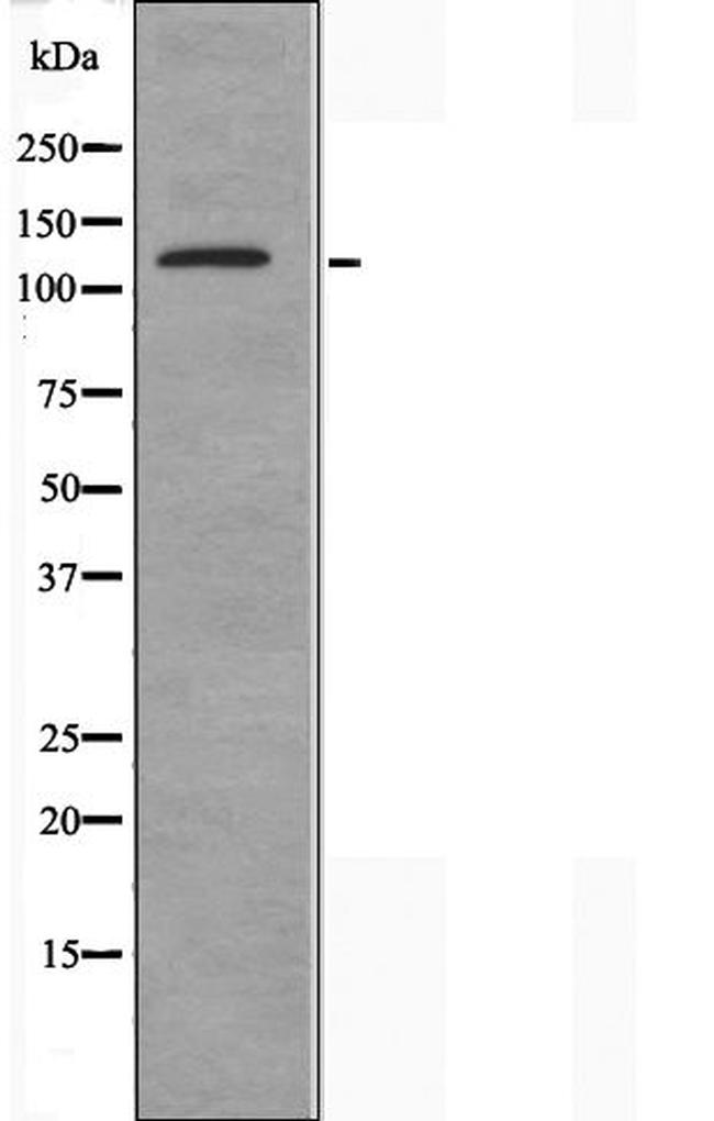 Atrophin 1 Antibody in Western Blot (WB)