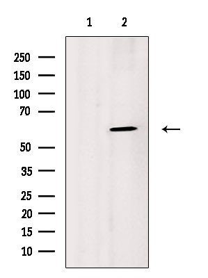 B4GALNT1 Antibody in Western Blot (WB)